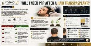 PRP-After-a-Hair-Transplant