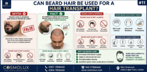 Beard Hair Be Used for a Hair Transplant