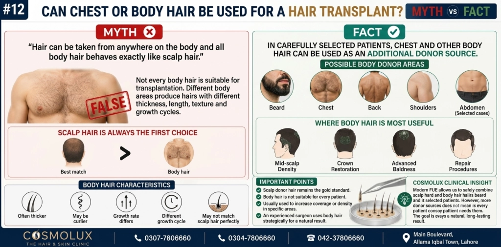 Can Chest or Body Hair Be Used for a Hair Transplant?
