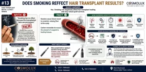 Smoking-Affect-Hair-Transplant-Results